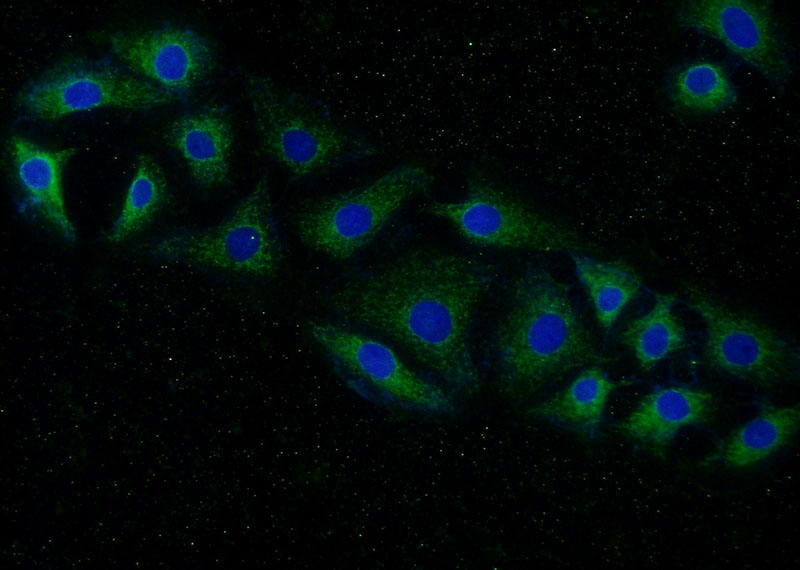 Immunofluorescent analysis of (-20oc Ethanol) fixed SH-SY5Y cells using Catalog No:114108(PPP3CA Antibody) at dilution of 1:50 and Alexa Fluor 488-congugated AffiniPure Goat Anti-Rabbit IgG(H+L)