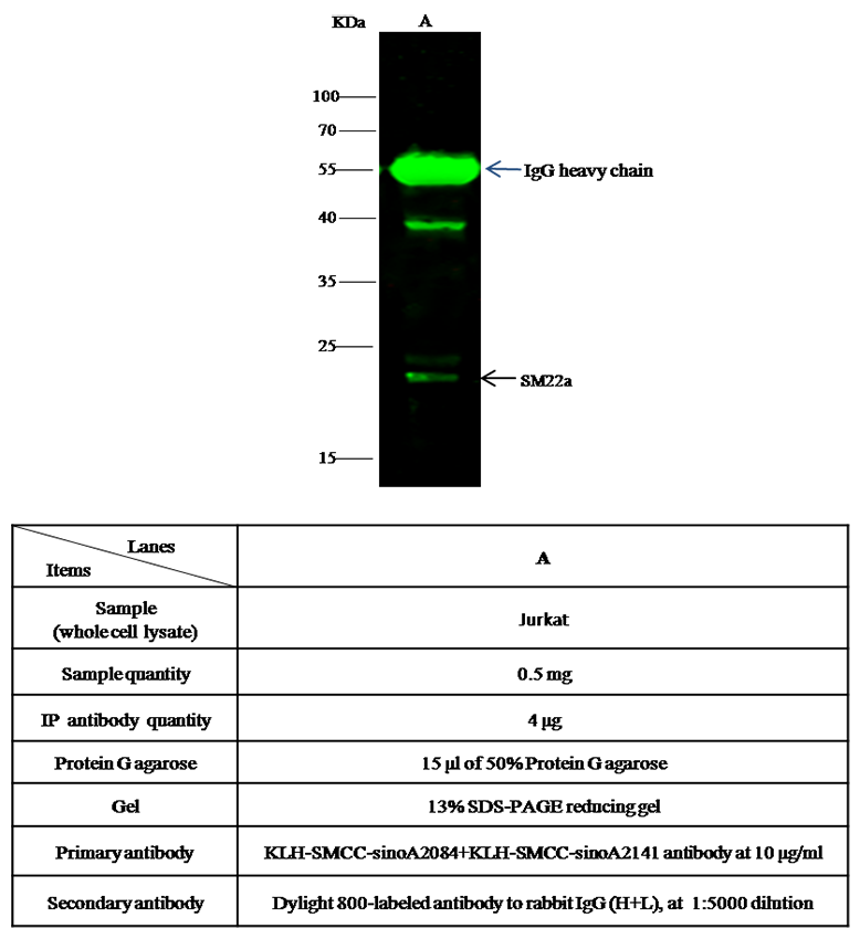 Human TAGLN Immunoprecipitation(IP) 15570