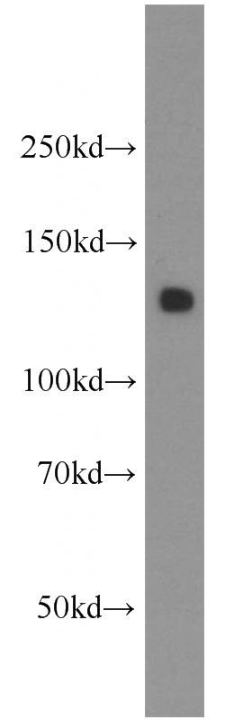 human stomach tissue were subjected to SDS PAGE followed by western blot with Catalog No:107999(AMOT antibody) at dilution of 1:500