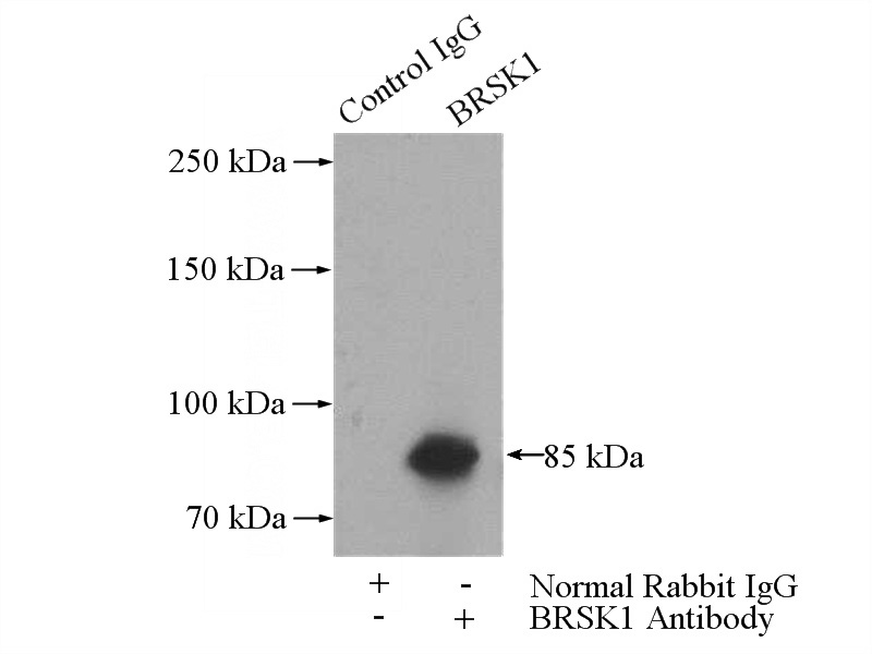 IP Result of anti-BRSK1 (IP:Catalog No:117244, 4ug; Detection:Catalog No:117244 1:500) with mouse brain tissue lysate 3440ug.