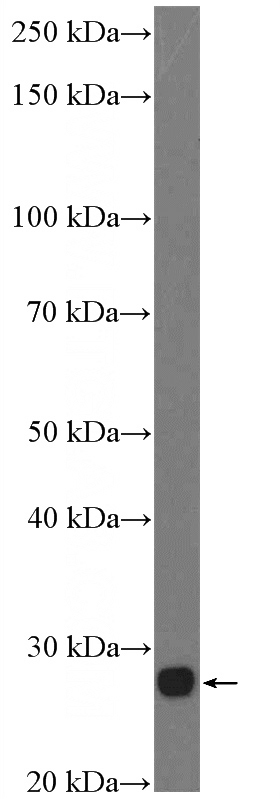 mouse eye tissue were subjected to SDS PAGE followed by western blot with Catalog No:114932(RS1 Antibody) at dilution of 1:600
