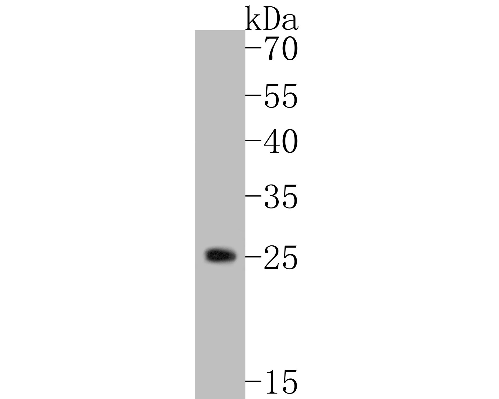 Fig1:; Western blot analysis of TREM2 on U937 cell lysates. Proteins were transferred to a PVDF membrane and blocked with 5% BSA in PBS for 1 hour at room temperature. The primary antibody ( 1/500) was used in 5% BSA at room temperature for 2 hours. Goat Anti-Rabbit IgG - HRP Secondary Antibody (HA1001) at 1:5,000 dilution was used for 1 hour at room temperature.