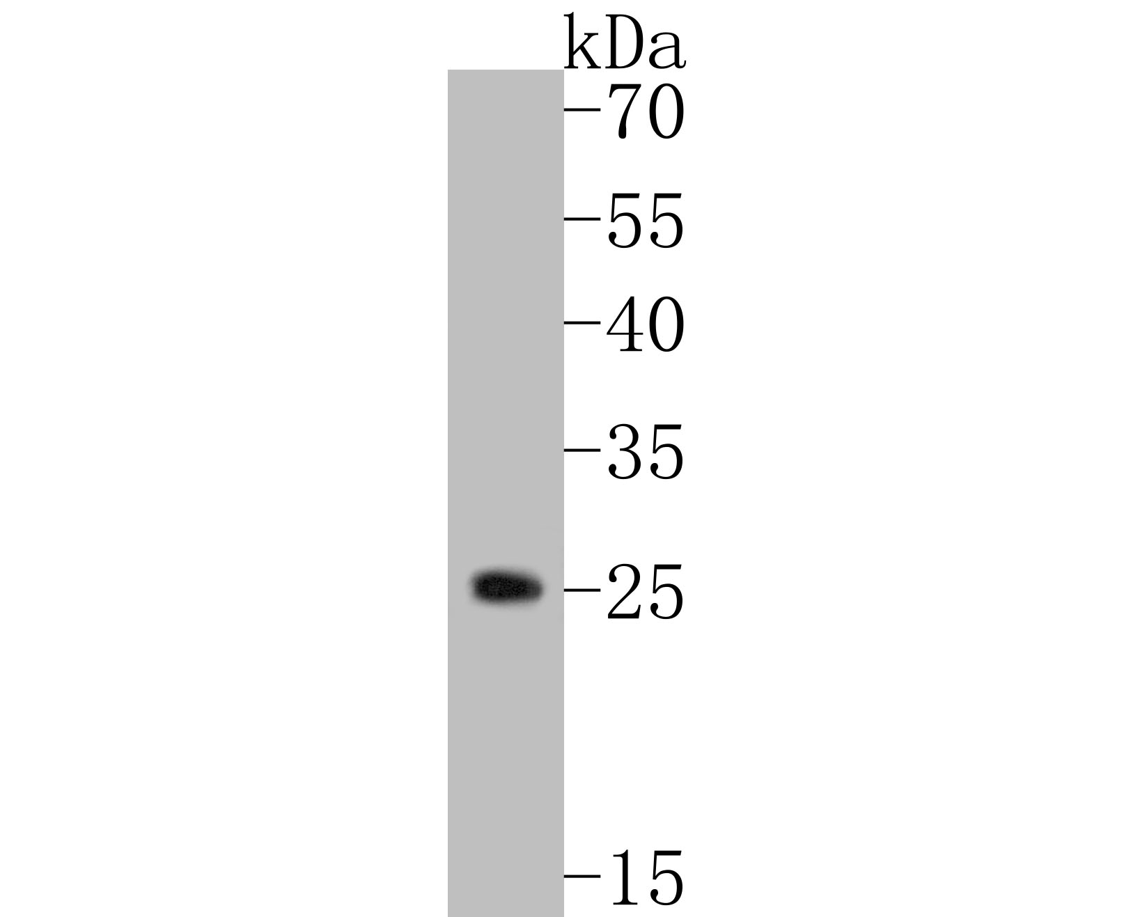 Fig1:; Western blot analysis of TREM2 on U937 cell lysates. Proteins were transferred to a PVDF membrane and blocked with 5% BSA in PBS for 1 hour at room temperature. The primary antibody ( 1/500) was used in 5% BSA at room temperature for 2 hours. Goat Anti-Rabbit IgG - HRP Secondary Antibody (HA1001) at 1:5,000 dilution was used for 1 hour at room temperature.