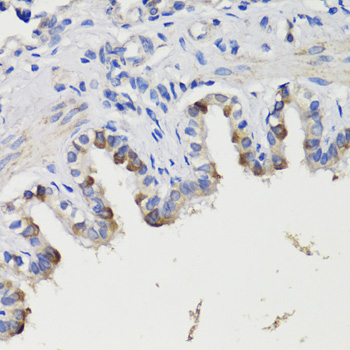 Immunohistochemistry - DEPDC6 Polyclonal Antibody 