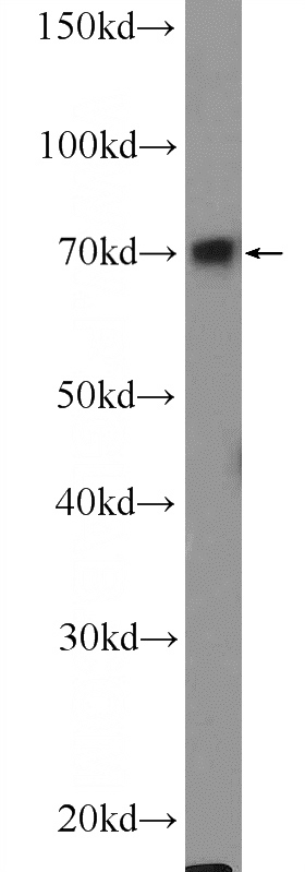 MCF-7 cells were subjected to SDS PAGE followed by western blot with Catalog No:110692(FOXC1 Antibody) at dilution of 1:300