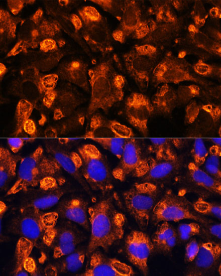 Immunofluorescence - FGA Polyclonal Antibody 