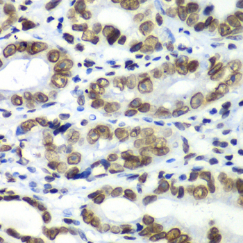 Immunohistochemistry - TEAD1 Polyclonal Antibody 