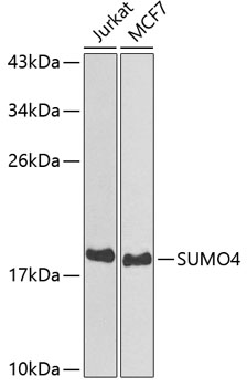 Western blot - SUMO4 Polyclonal Antibody 