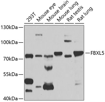 Western blot - FBXL5 Polyclonal Antibody 