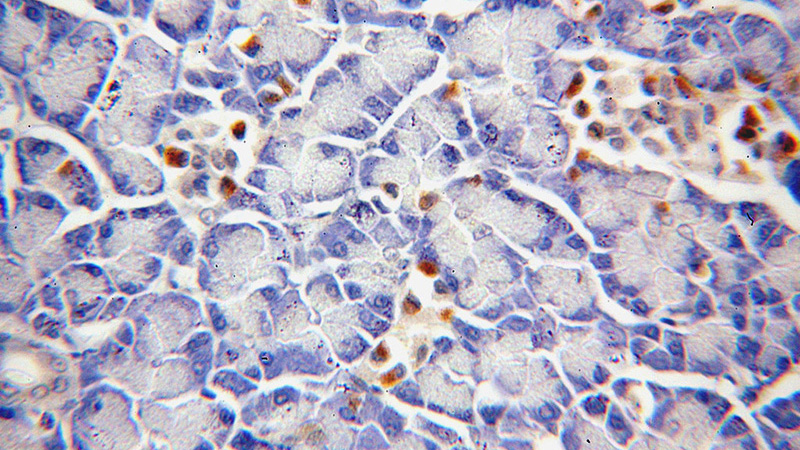 Immunohistochemical of paraffin-embedded human pancreas using Catalog No:115329(SLC25A23 antibody) at dilution of 1:100 (under 40x lens)