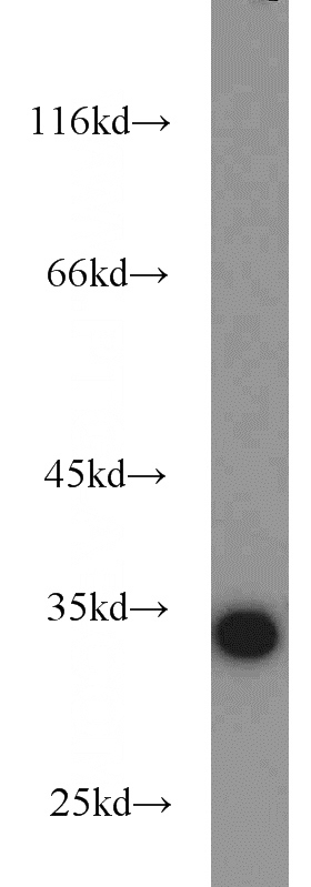 HeLa cells were subjected to SDS PAGE followed by western blot with Catalog No:114217(PHB2 antibody) at dilution of 1:1000