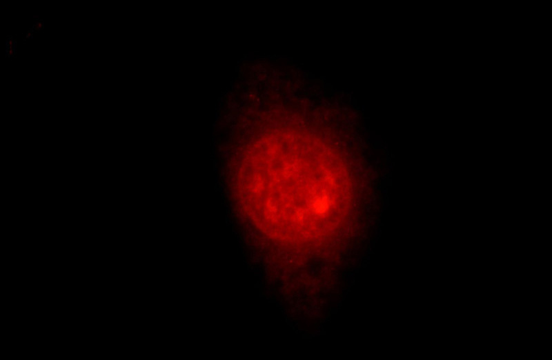 Immunofluorescent analysis of HepG2 cells, using MTA3 antibody Catalog No:112764 at 1:50 dilution and Rhodamine-labeled goat anti-rabbit IgG (red).
