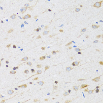 Immunohistochemistry - CHRM5 Polyclonal Antibody 