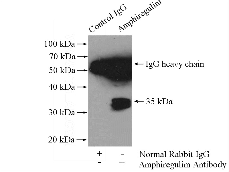 IP Result of anti-AREG (IP:Catalog No:108005, 4ug; Detection:Catalog No:108005 1:2000) with HepG2 cells lysate 3600ug.
