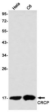 Western blot detection of CRCP in Hela,C6 using CRCP Rabbit mAb(1:1000 diluted)