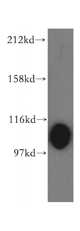 HepG2 cells were subjected to SDS PAGE followed by western blot with Catalog No:112777(MTHFD1L antibody) at dilution of 1:500