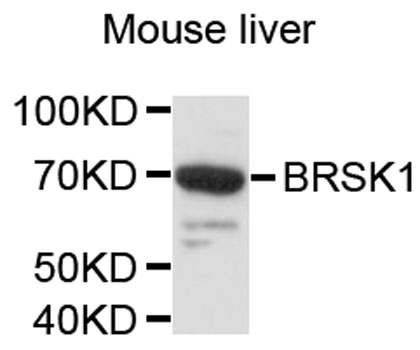 Western blot - BRSK1 Polyclonal Antibody 