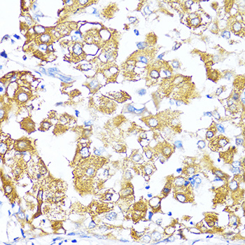 Immunohistochemistry - TGFB2 Polyclonal Antibody 