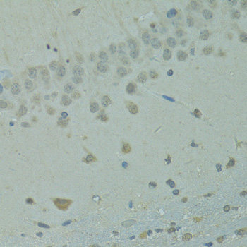Immunohistochemistry - IVNS1ABP Polyclonal Antibody 