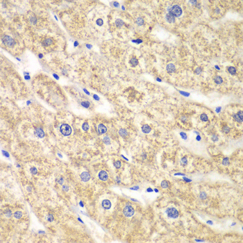Immunohistochemistry - ACADS Polyclonal Antibody 