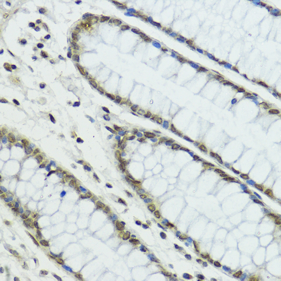 Immunohistochemistry - TRIP12 Polyclonal Antibody 