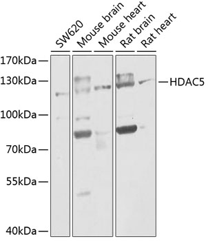 Western blot - HDAC5 Polyclonal Antibody 