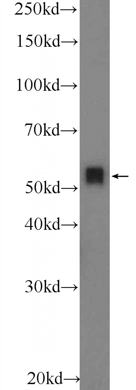 mouse brain tissue were subjected to SDS PAGE followed by western blot with Catalog No:116034(TH Antibody) at dilution of 1:600