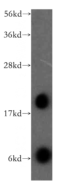 human brain tissue were subjected to SDS PAGE followed by western blot with Catalog No:109424(CNIH3 antibody) at dilution of 1:400