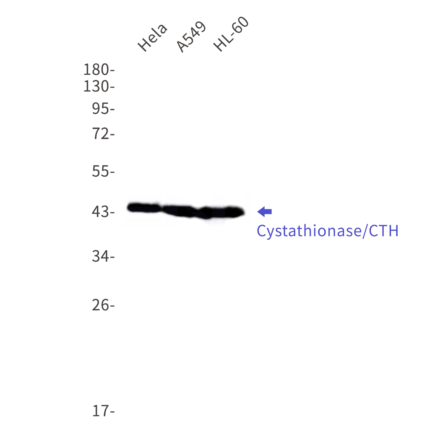 Western blot detection of Cystathionase/CTH in Hela,A549,HL-60 cell lysates using Cystathionase/CTH Rabbit mAb(1:1000 diluted).Predicted band size:45kDa.Observed band size:45kDa.