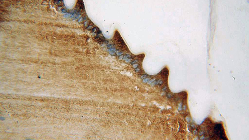 Immunohistochemical of paraffin-embedded human eye using Catalog No:107868(CRYAB antibody) at dilution of 1:100 (under 40x lens)