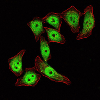 Immunofluorescence analysis of ECA109 cells using KLF4 mouse mAb (green). Red