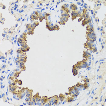 Immunohistochemistry - B9D1 Polyclonal Antibody 