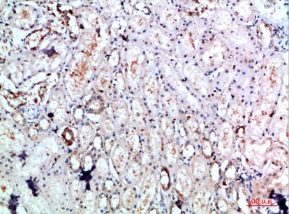 Fig1:; Immunohistochemical analysis of paraffin-embedded human-kidney, antibody was diluted at 1:200