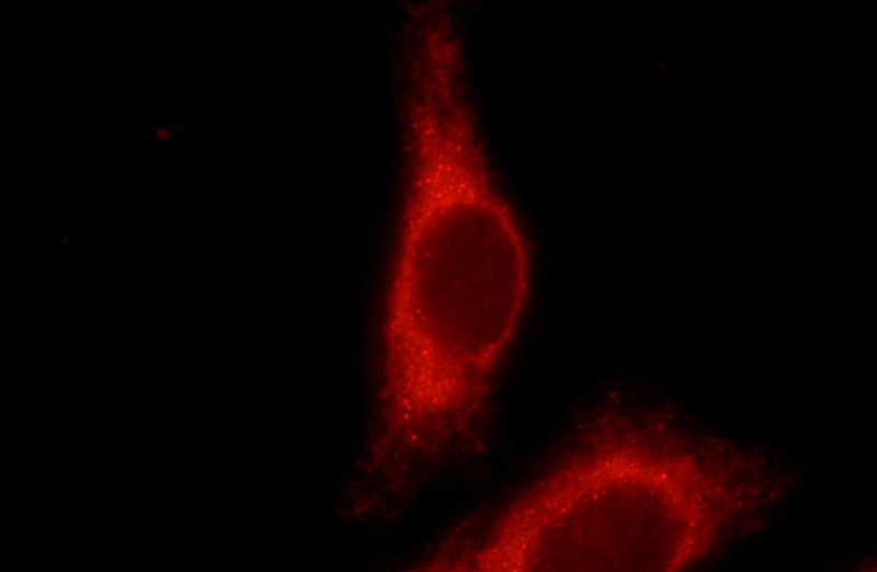 Immunofluorescent analysis of HepG2 cells using Catalog No:114153(PPP1R15B;CReP Antibody) at dilution of 1:50 and Rhodamine-labeled goat anti-rabbit IgG .