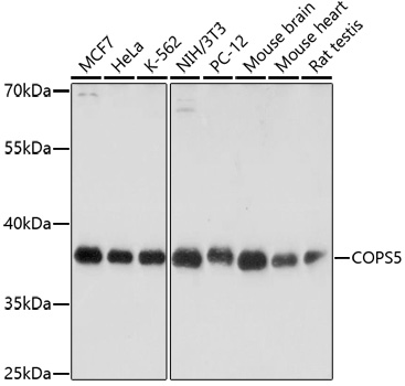 Western blot - COPS5 Polyclonal Antibody 