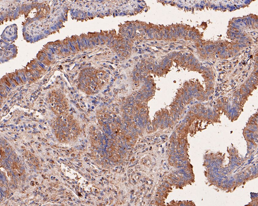 Fig3:; Immunohistochemical analysis of paraffin-embedded human fallopian tube tissue using anti-NMBR antibody. The section was pre-treated using heat mediated antigen retrieval with Tris-EDTA buffer (pH 9.0) for 20 minutes.The tissues were blocked in 1% BSA for 30 minutes at room temperature, washed with ddH; 2; O and PBS, and then probed with the primary antibody ( 1/400) for 30 minutes at room temperature. The detection was performed using an HRP conjugated compact polymer system. DAB was used as the chromogen. Tissues were counterstained with hematoxylin and mounted with DPX.