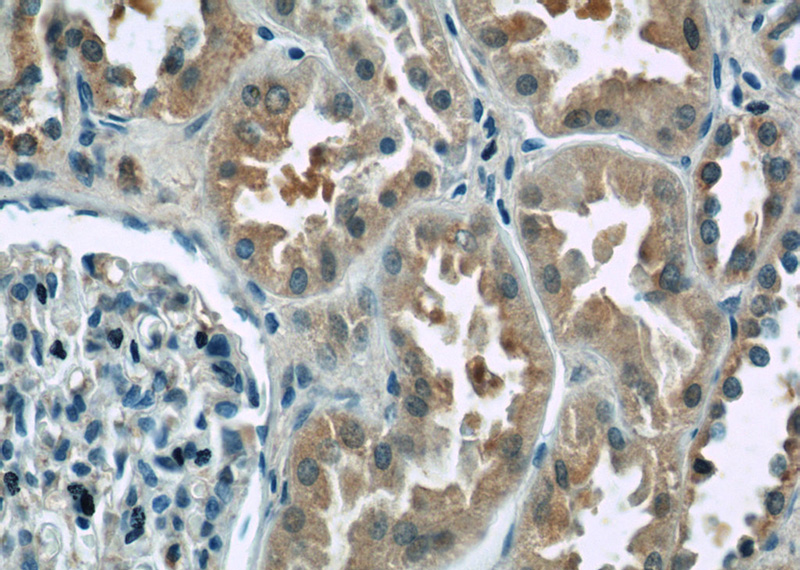 Immunohistochemistry of paraffin-embedded human kidney tissue slide using Catalog No:108079(ANKRD53 Antibody) at dilution of 1:50 (under 40x lens)