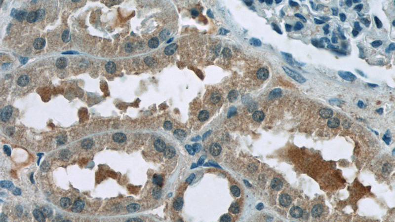 Immunohistochemistry of paraffin-embedded human kidney tissue slide using Catalog No:108536(BTBD16 Antibody) at dilution of 1:50 (under 40x lens)