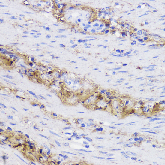 Immunohistochemistry - COL1A1 Polyclonal Antibody 