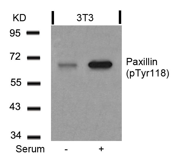 Western blot analysis of extracts from 3T3 cells untreated or treated with serum using Paxillin (Phospho-Tyr118) Antibody .