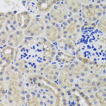 Immunohistochemistry - HK3 Polyclonal Antibody 