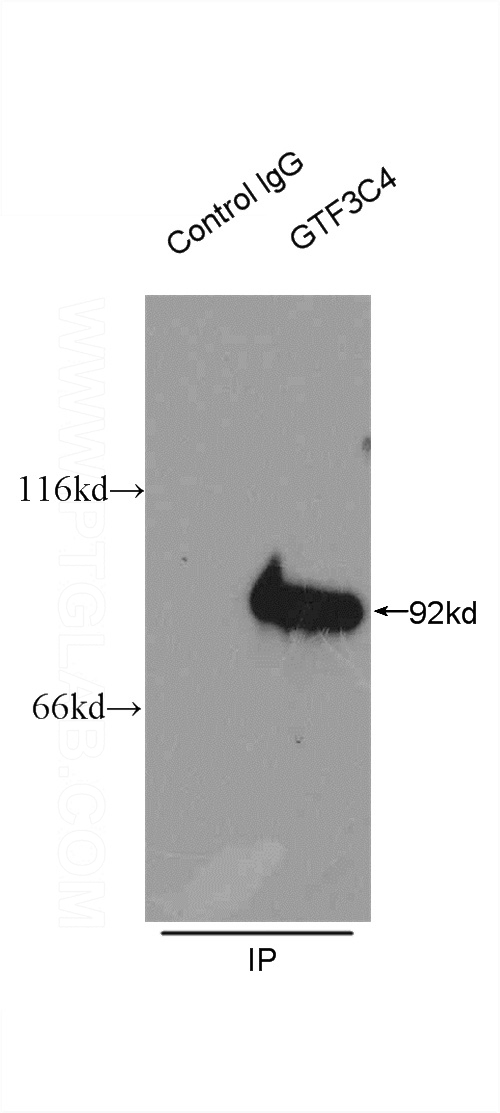 IP Result of anti-GTF3C4 (IP:Catalog No:111238, 3ug; Detection:Catalog No:111238 1:800) with HeLa cells lysate 875ug.