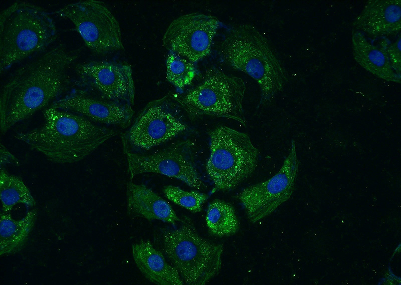 Immunofluorescent analysis of (-20oc Ethanol) fixed SH-SY5Y cells using Catalog No:116375(TTBK2 Antibody) at dilution of 1:50 and Alexa Fluor 488-congugated AffiniPure Goat Anti-Rabbit IgG(H+L)