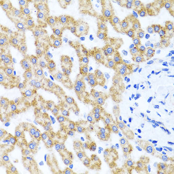 Immunohistochemistry - RIPK4 Polyclonal Antibody 