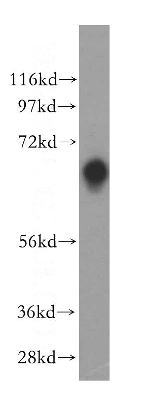 human colon tissue were subjected to SDS PAGE followed by western blot with Catalog No:116374(TSTA3 antibody) at dilution of 1:500