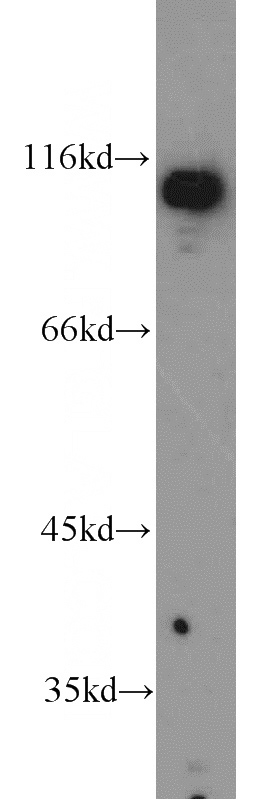RAW264.7 cells were subjected to SDS PAGE followed by western blot with Catalog No:113323(ODC1 antibody) at dilution of 1:1000