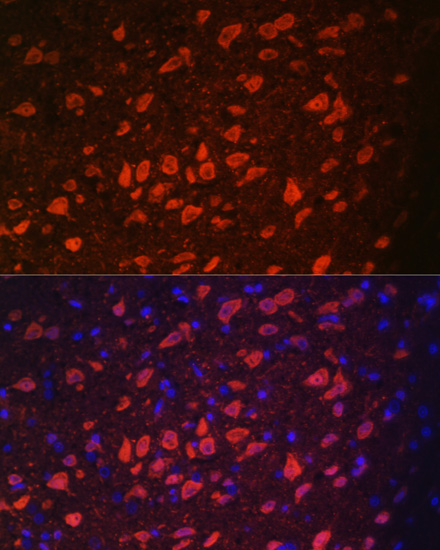 Immunofluorescence - TRPM2 Polyclonal Antibody 
