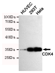 Western blot analysis of extracts from Hela,293T and HUVEC cells using CDK4 rabbit pAb (1:1000 diluted).Predicted band size:34KDa.Observed band size:34KDa.