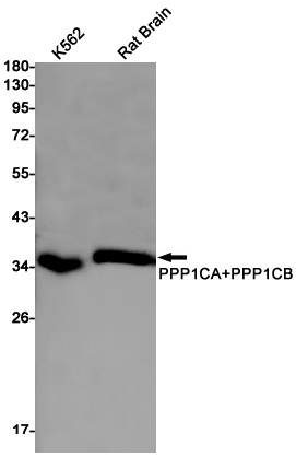 Western blot detection of PPP1CA+PPP1CB in K562,Rat Brain cell lysates using PPP1CA+PPP1CB Rabbit pAb(1:1000 diluted).Predicted band size:38kDa.Observed band size:38kDa.