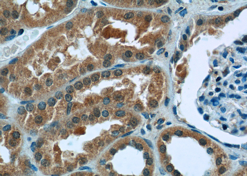 Immunohistochemistry of paraffin-embedded human kidney tissue slide using Catalog No:116929(ZC3HAV1 Antibody) at dilution of 1:50 (under 40x lens)